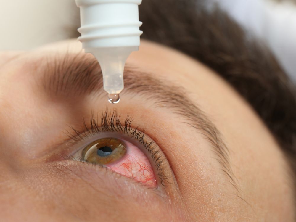 Nomes de doenças nos olhos que todo cuidador precisa ter em mente